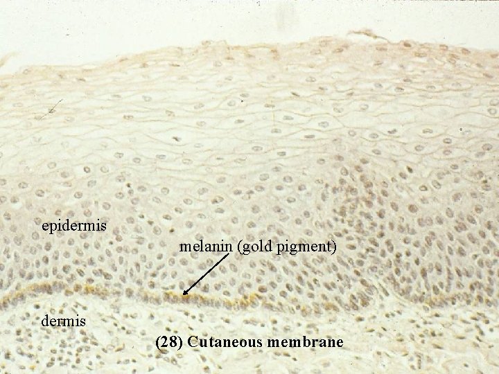 epidermis melanin (gold pigment) dermis (28) Cutaneous membrane Bio 348 Lapsansky - 2007 