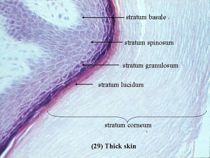 stratum basale stratum spinosum stratum granulosum stratum lucidum stratum corneum (29) Thick skin Bio