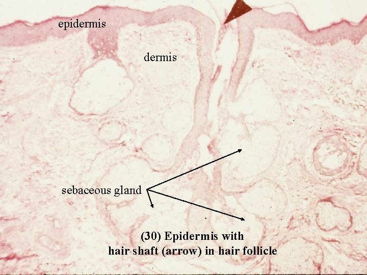 epidermis sebaceous gland (30) Epidermis with hair shaft (arrow) in hair follicle Bio 348