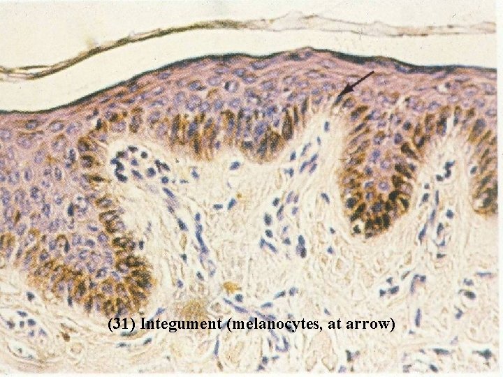 (31) Integument (melanocytes, at arrow) Bio 348 Lapsansky - 2007 