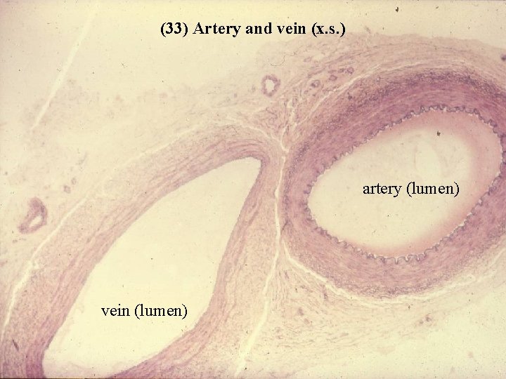 (33) Artery and vein (x. s. ) artery (lumen) vein (lumen) Bio 348 Lapsansky