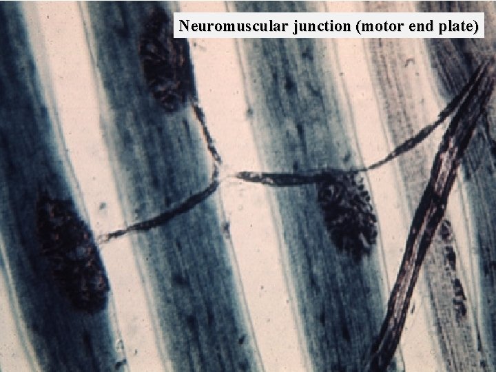 Neuromuscular junction (motor end plate) Bio 348 Lapsansky - 2007 