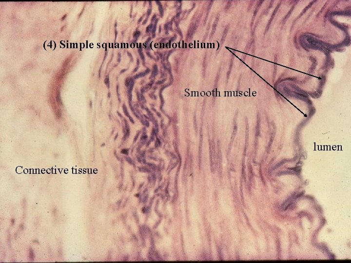 (4) Simple squamous (endothelium) Smooth muscle lumen Connective tissue Bio 348 Lapsansky - 2007