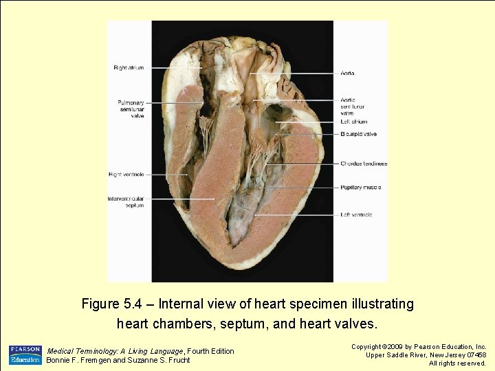 Figure 5. 4 – Internal view of heart specimen illustrating heart chambers, septum, and