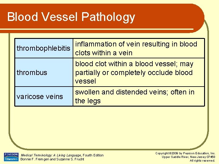 Blood Vessel Pathology thrombophlebitis inflammation of vein resulting in blood clots within a vein