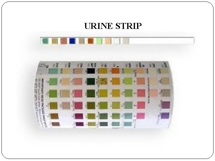 URINE STRIP 