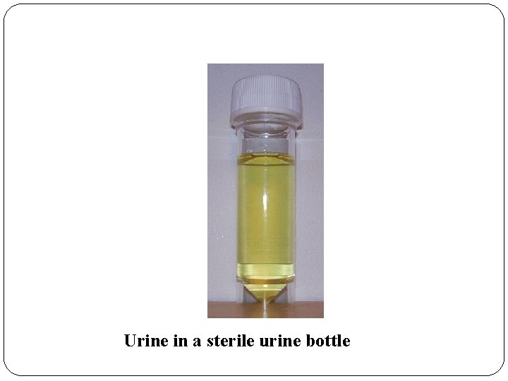 Urine in a sterile urine bottle 