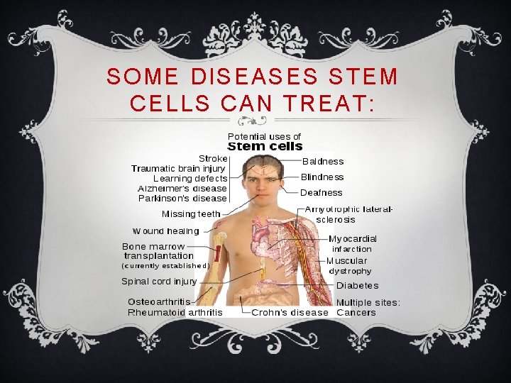 SOME DISEASES STEM CELLS CAN TREAT: 