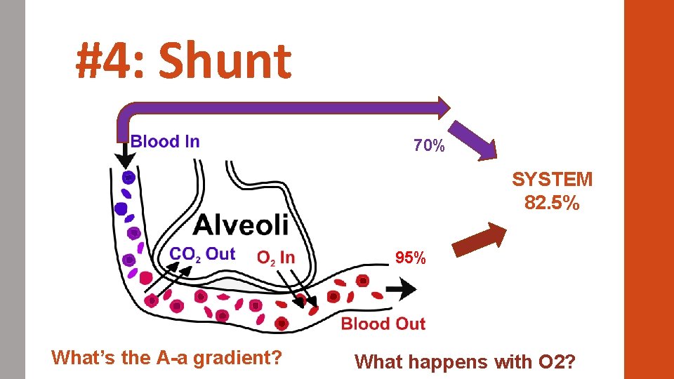 #4: Shunt 70% SYSTEM 82. 5% 95% What’s the A-a gradient? What happens with