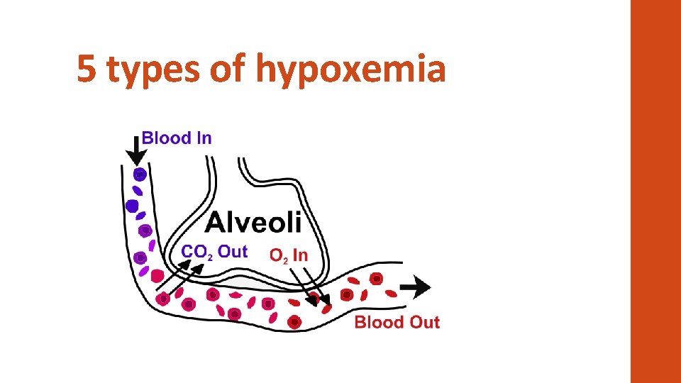 5 types of hypoxemia 