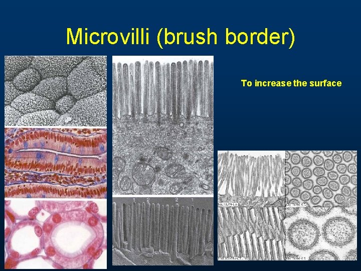 Microvilli (brush border) To increase the surface Microvilli (brush border) To increase the surface