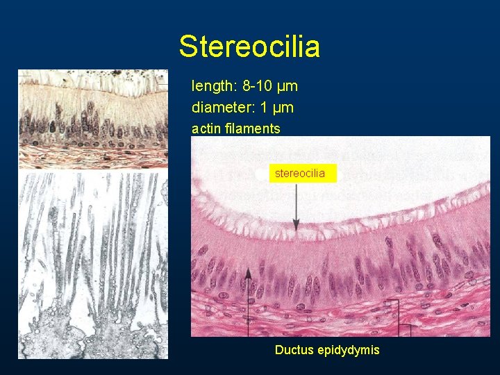Stereocilia length: 8 -10 µm diameter: 1 µm actin filaments stereocilia Ductus epidydymis Stereocilia length: 8 -10 µm diameter: 1 µm actin filaments stereocilia Ductus epidydymis