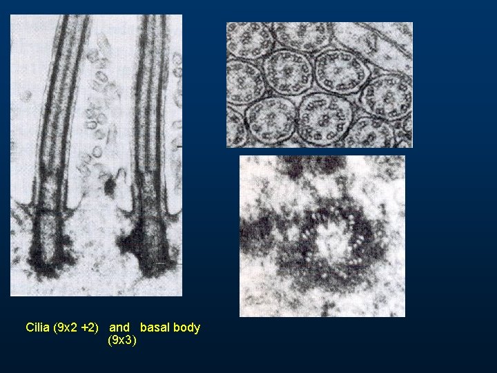 Cilia (9 x 2 +2) and basal body (9 x 3) Cilia (9 x 2 +2) and basal body (9 x 3)