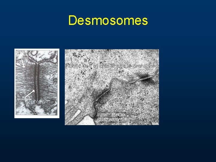 Desmosomes Desmosomes