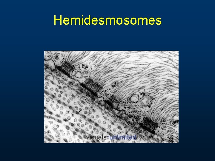 Hemidesmosomes Hemidesmosomes