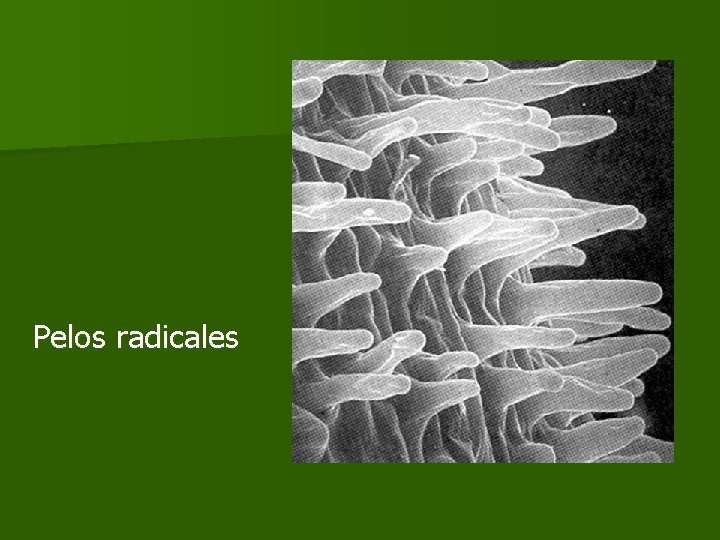 Pelos radicales Pelos radicales