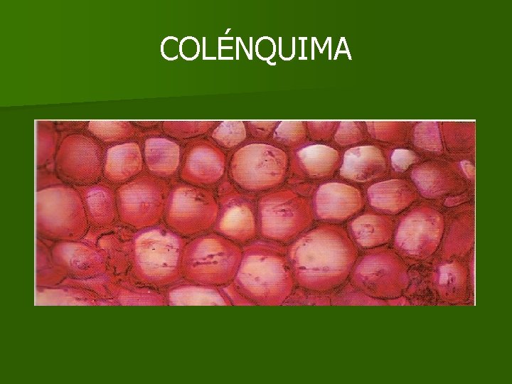 COLÉNQUIMA COLÉNQUIMA