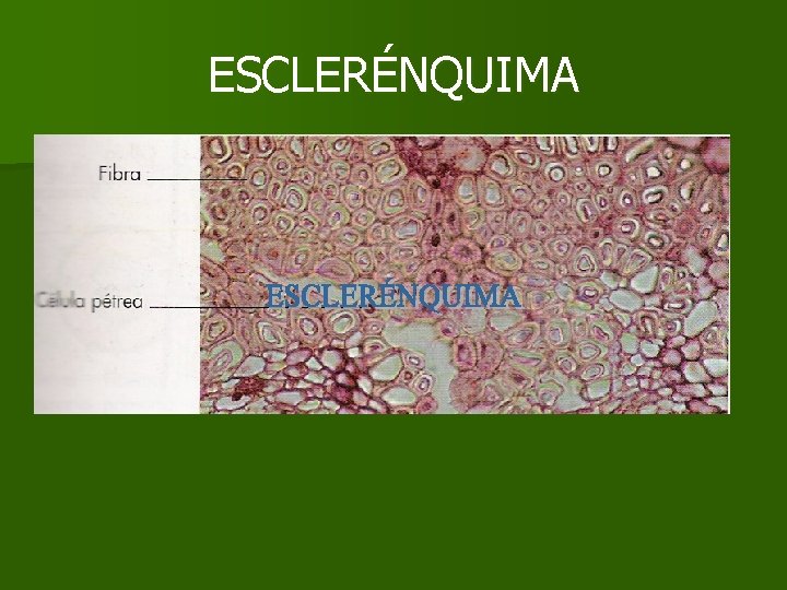ESCLERÉNQUIMA ESCLERÉNQUIMA