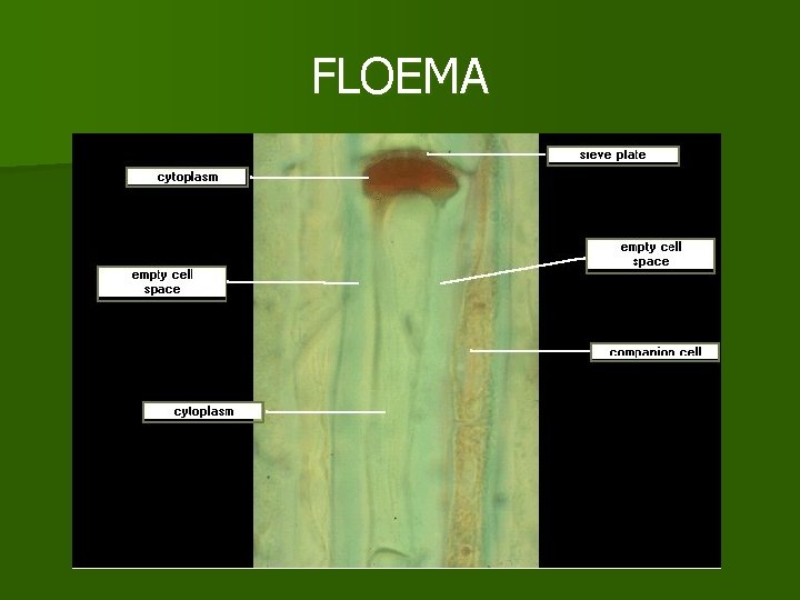 FLOEMA FLOEMA