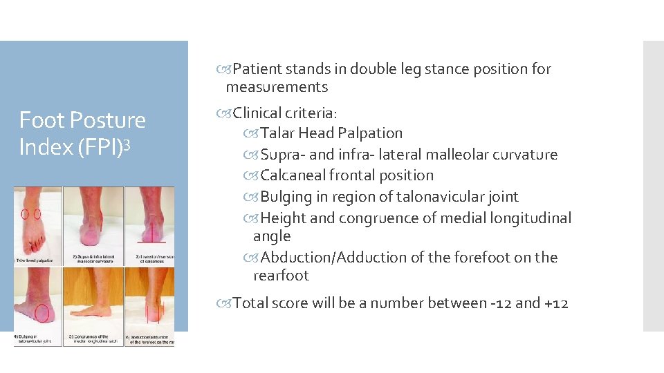  Patient stands in double leg stance position for measurements Foot Posture Index (FPI)3