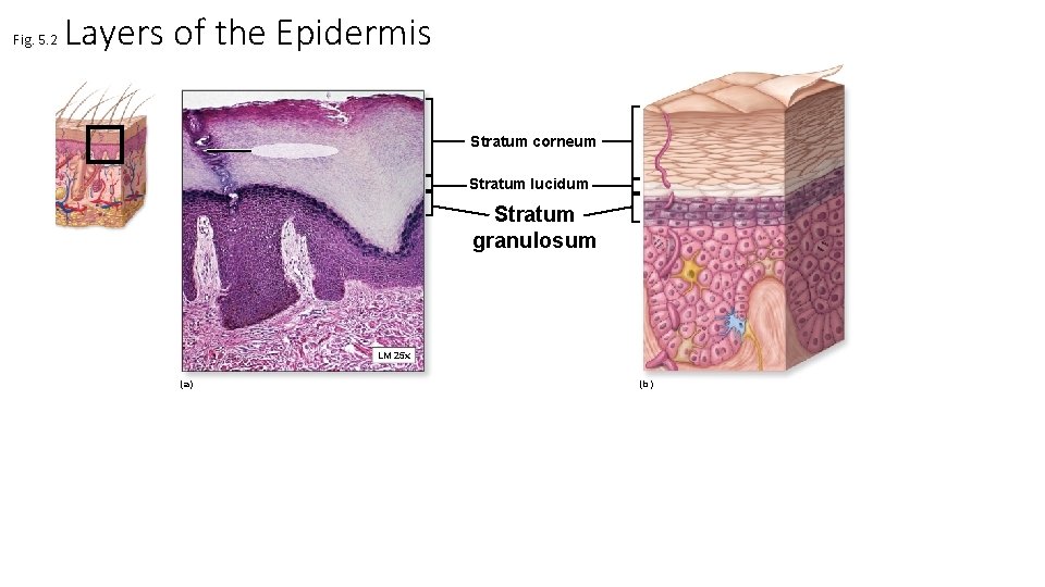 Fig. 5. 2 Layers of the Epidermis Stratum corneum Stratum lucidum Stratum granulosum LM