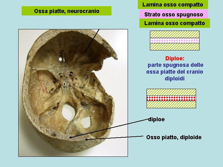 Lamina osso compatto Ossa piatte, neurocranio Strato osso spugnoso Lamina osso compatto Diploe: parte