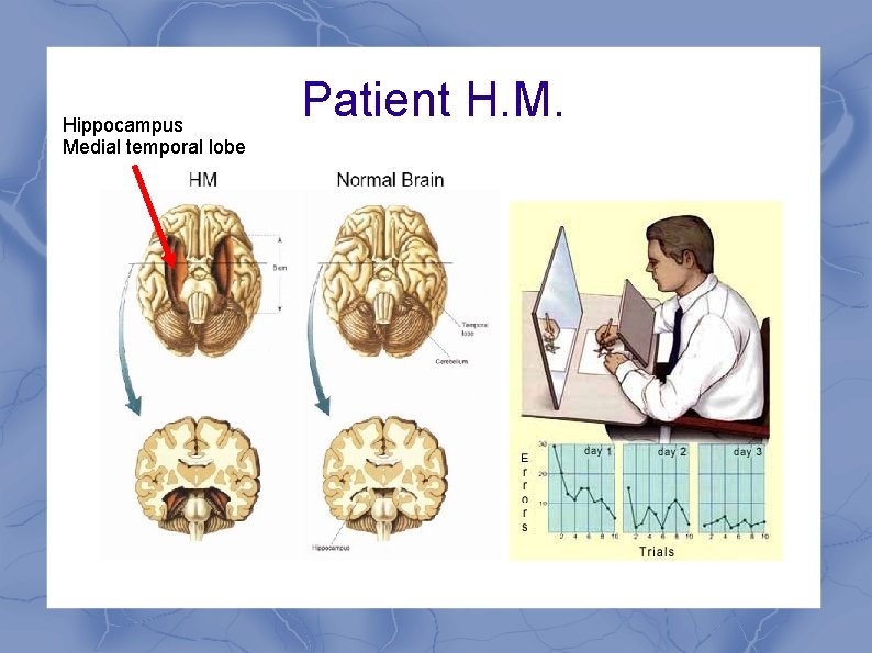 Hippocampus Medial temporal lobe Patient H. M. 