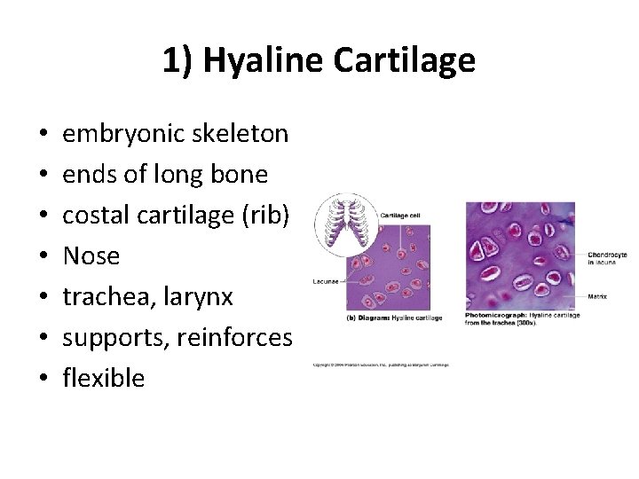 1) Hyaline Cartilage • • embryonic skeleton ends of long bone costal cartilage (rib)