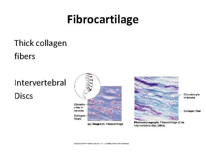 Fibrocartilage Thick collagen fibers Intervertebral Discs 