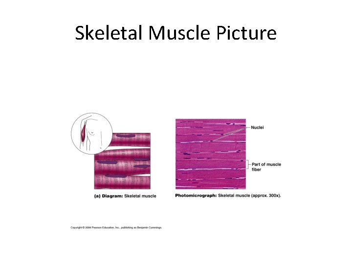 Skeletal Muscle Picture 