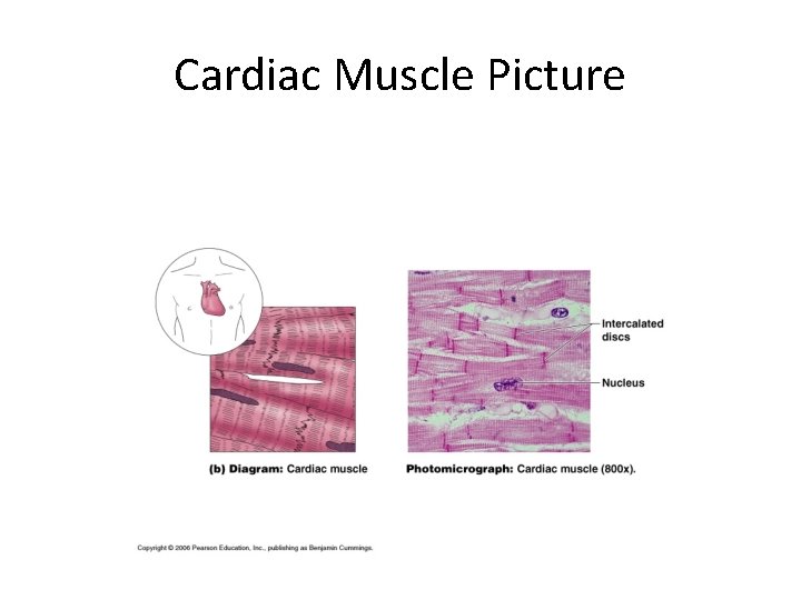 Cardiac Muscle Picture 