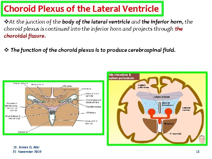 Choroid Plexus of the Lateral Ventricle v. At the junction of the body of