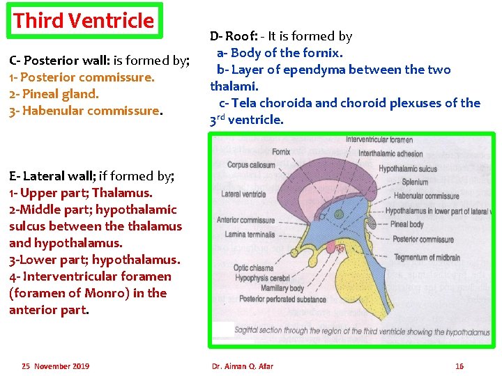 Third Ventricle C- Posterior wall: is formed by; 1 - Posterior commissure. 2 -