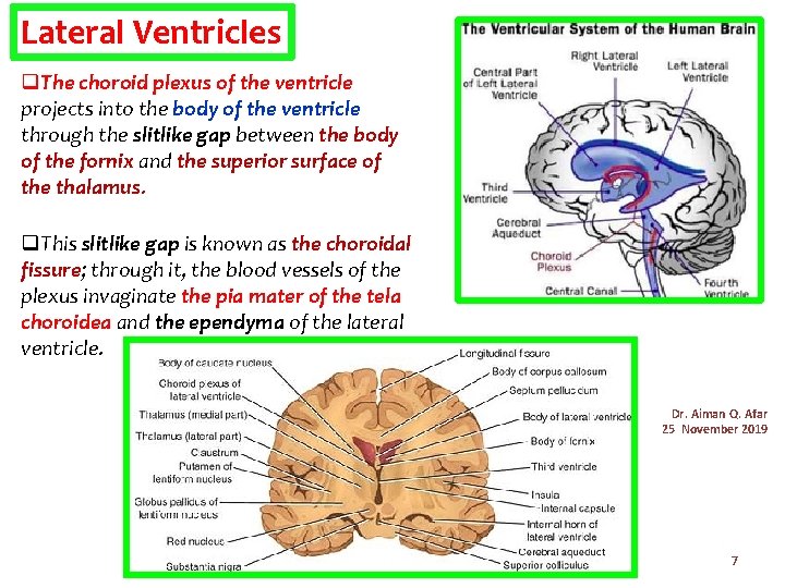 Lateral Ventricles q. The choroid plexus of the ventricle projects into the body of