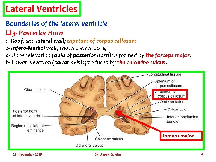 Lateral Ventricles Boundaries of the lateral ventricle q 3 - Posterior Horn 1 -