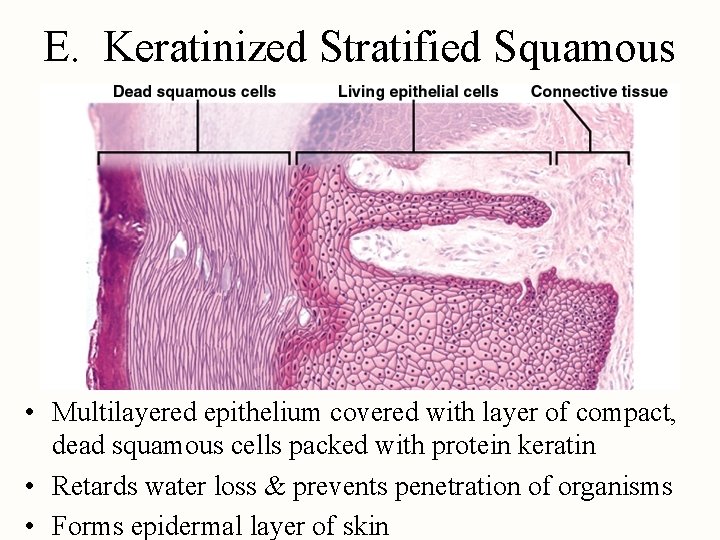 E. Keratinized Stratified Squamous • Multilayered epithelium covered with layer of compact, dead squamous