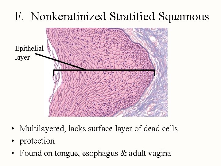 F. Nonkeratinized Stratified Squamous Epithelial layer • Multilayered, lacks surface layer of dead cells