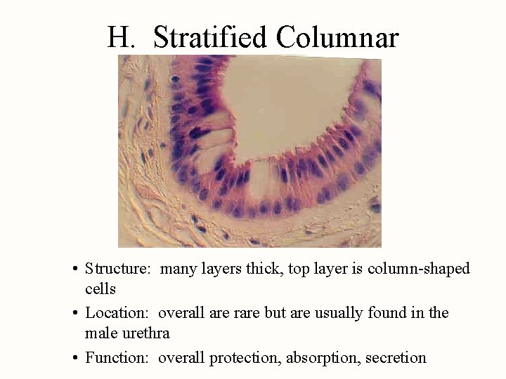 H. Stratified Columnar • Structure: many layers thick, top layer is column-shaped cells •