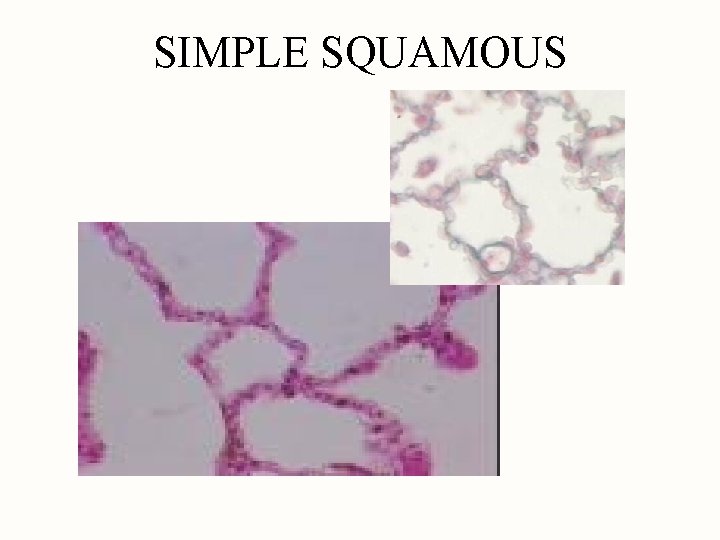 SIMPLE SQUAMOUS 