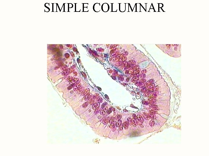 SIMPLE COLUMNAR 