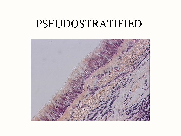 PSEUDOSTRATIFIED 