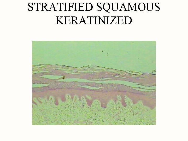 STRATIFIED SQUAMOUS KERATINIZED 