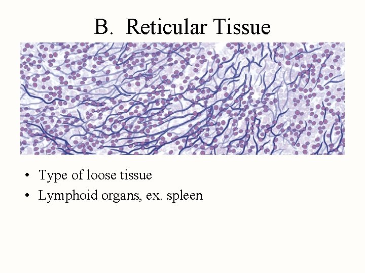 B. Reticular Tissue • Type of loose tissue • Lymphoid organs, ex. spleen 