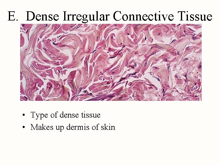 E. Dense Irregular Connective Tissue • Type of dense tissue • Makes up dermis