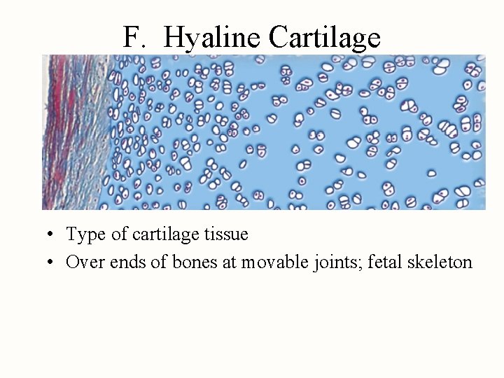 F. Hyaline Cartilage • Type of cartilage tissue • Over ends of bones at