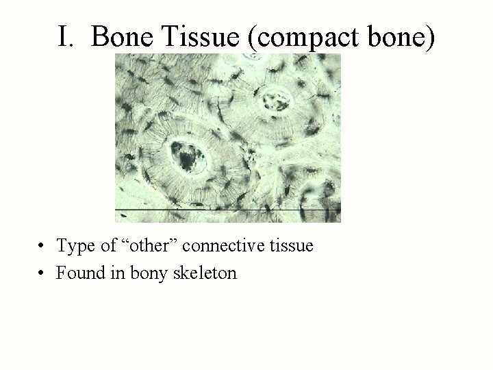 I. Bone Tissue (compact bone) • Type of “other” connective tissue • Found in