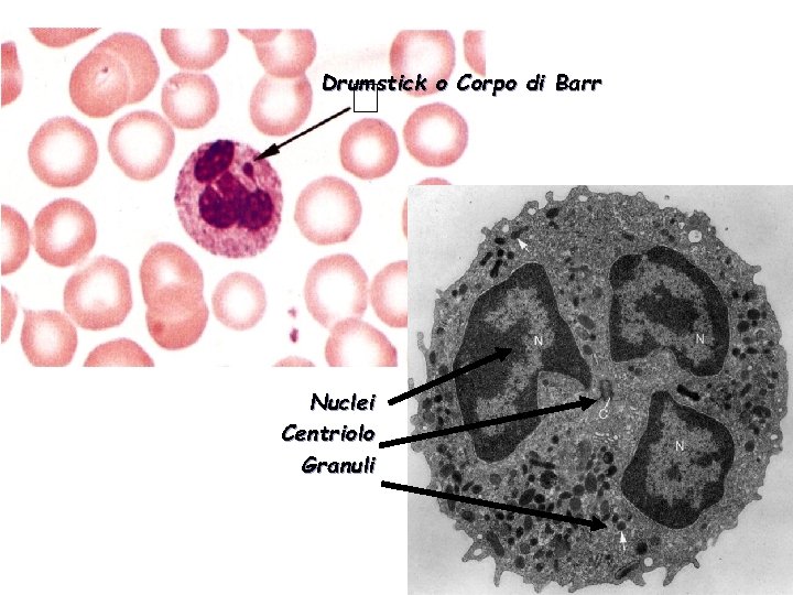 Drumstick o Corpo di Barr Nuclei Centriolo Granuli 