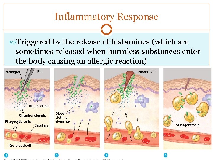 Inflammatory Response Triggered by the release of histamines (which are sometimes released when harmless