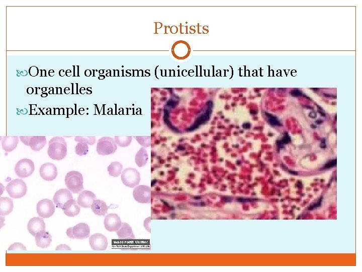 Protists One cell organisms (unicellular) that have organelles Example: Malaria 