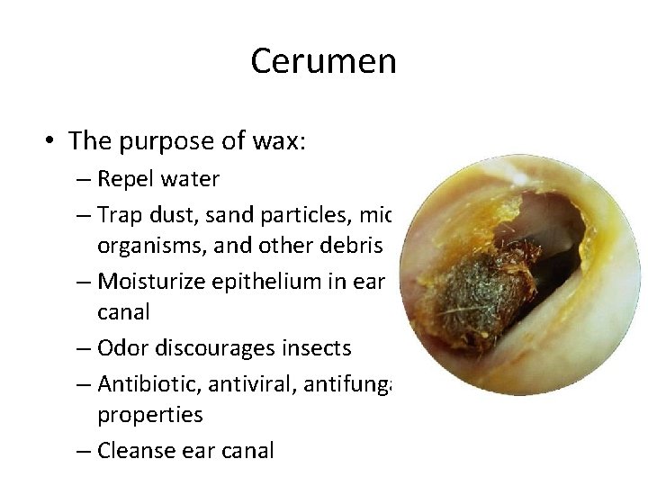 Cerumen • The purpose of wax: – Repel water – Trap dust, sand particles,